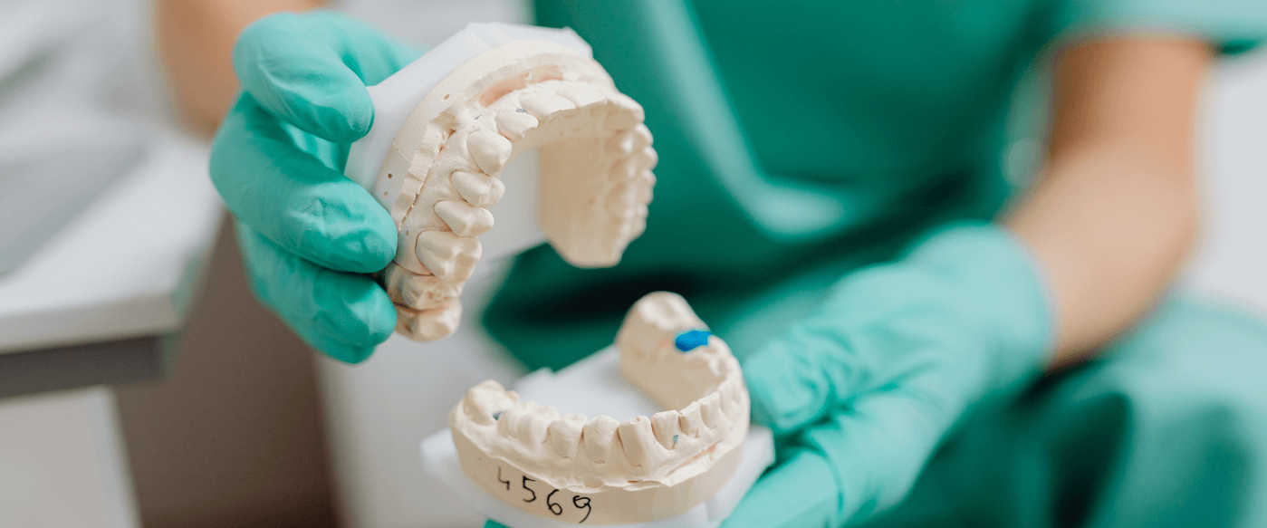 ¿Cuánto cobra un protésico dental? Sal de dudas ahora ¿Cuánto cobra un protésico dental? Sal de dudas ahora