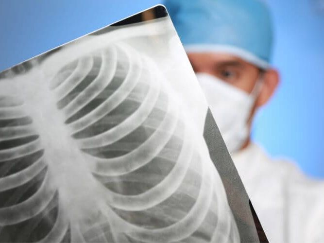 densidades radiologicas densidades radiologicas