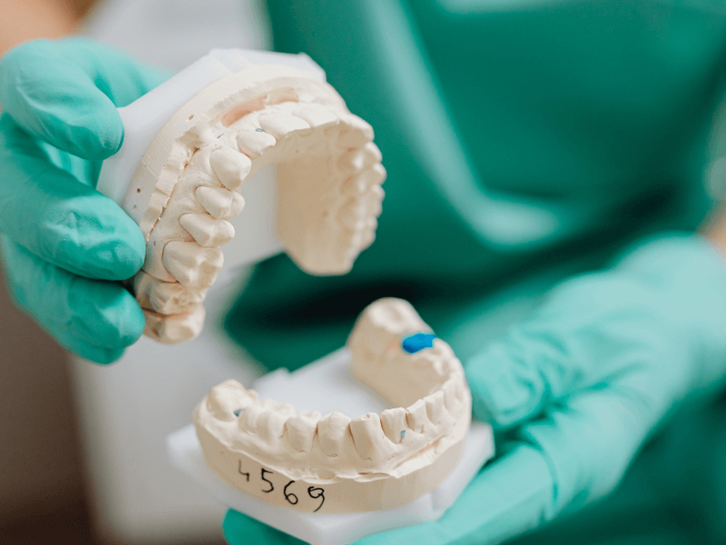 ¿Cuánto cobra un protésico dental? Sal de dudas ahora ¿Cuánto cobra un protésico dental? Sal de dudas ahora