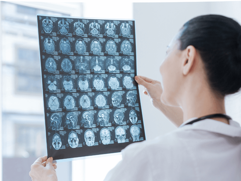 Carrera de Radiología: Tu plan de futuro, a escáner Carrera de Radiología: Tu plan de futuro, a escáner