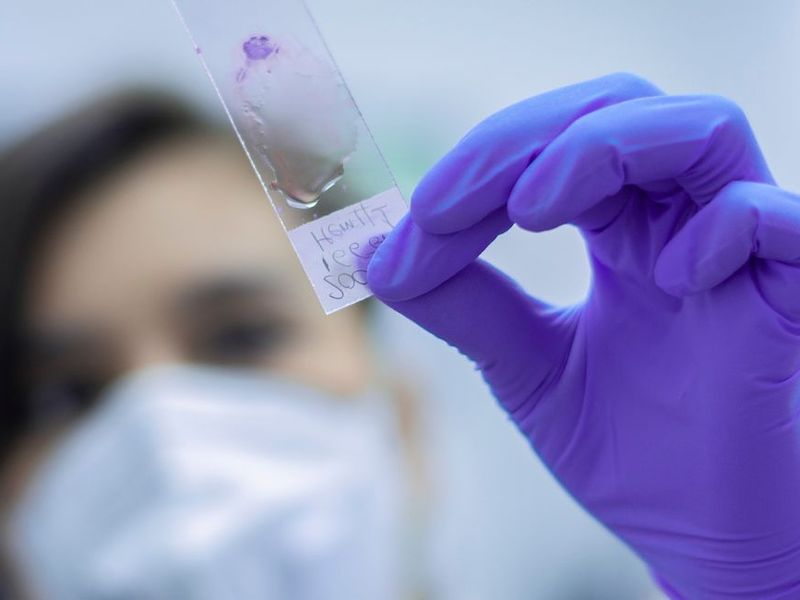 Técnico superior en laboratorio clínico y biomédico sueldo Técnico superior en laboratorio clínico y biomédico sueldo