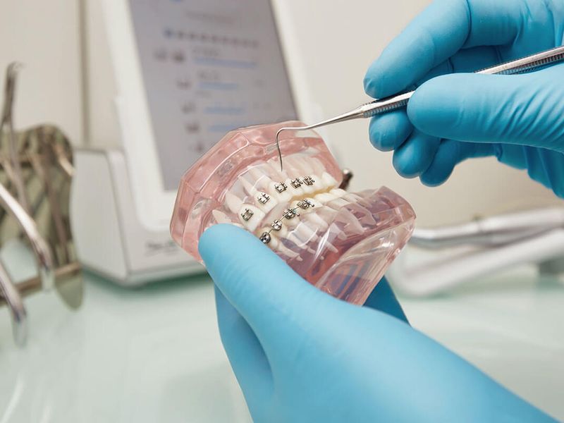 ortodoncia ortodoncia